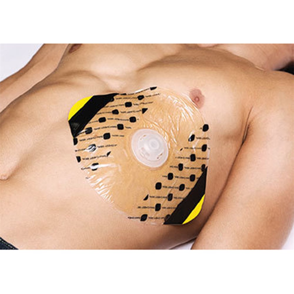 ПРЕВРЪЗКИ ЗА ГРЪДНИ РАНИ SAM® CHEST SEAL VALVED 2.0
